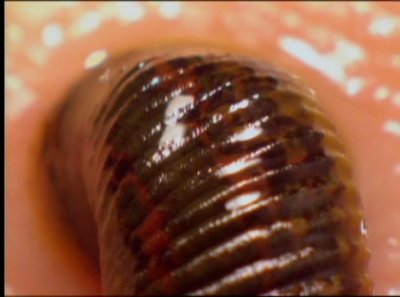 Discovery:  : ,    / Discovery: Leeches, Maggots And Bees: The Bite That Cures (2000) DVDRip
