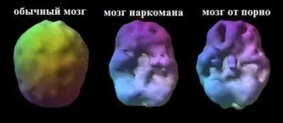 Что надо знать об эротике? (энерго-информационная безопасность)