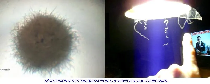 Метастазы Мексиканского залива. Часть 9-2 Метастазы Мексиканского залива. Часть 9-2