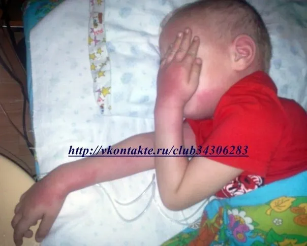 СРОЧНО НЕОБХОДИМА ПОМОЩЬ МАЛЕНЬКОМУ ЕГОРКЕ (4года) СРОЧНО НЕОБХОДИМА ПОМОЩЬ МАЛЕНЬКОМУ ЕГОРКЕ (4года)
