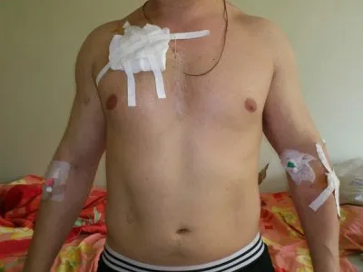 В Твери совершенно нападение на участника Народного Схода / Обновление