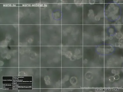 Замороженная структурированная вода под микроскопом, обработанная с помощью торсионных технологий (продолжение)