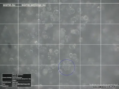 Замороженная структурированная вода под микроскопом, обработанная с помощью торсионных технологий (продолжение)