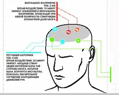 Электростимуляция мозга - как включить турборежим