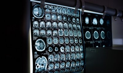 МРТ-сканирование и технология искусственного интеллекта действительно могут прочитать то, что мы думаем — последствия ужасающие