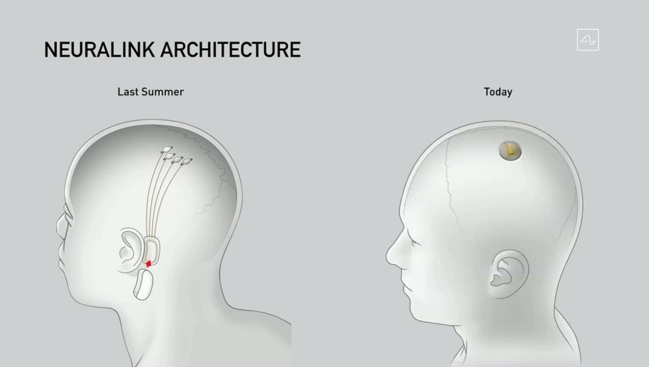 Маск вживил чип в мозг. Нейроинтерфейс Нейролинк. Нейрокомпьютерный Интерфейс Neuralink. Neuralink - чипы маска. Имплант Neuralink.